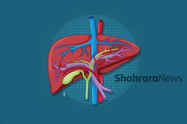 اینفوگرافی | قاتلان اصلی کبد را بشناسید